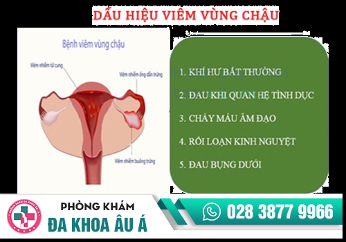 Ra máu khi quan hệ do viêm vùng chậu